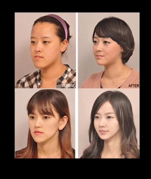 Korean Plastic Surgery 